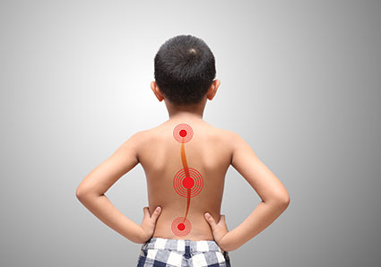 Scoliosis Formetric Tophography Blog Post Utah Physical Therapy